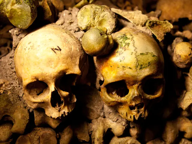 Largegrowth eliminated from woman's facial area by Australian medical professionals